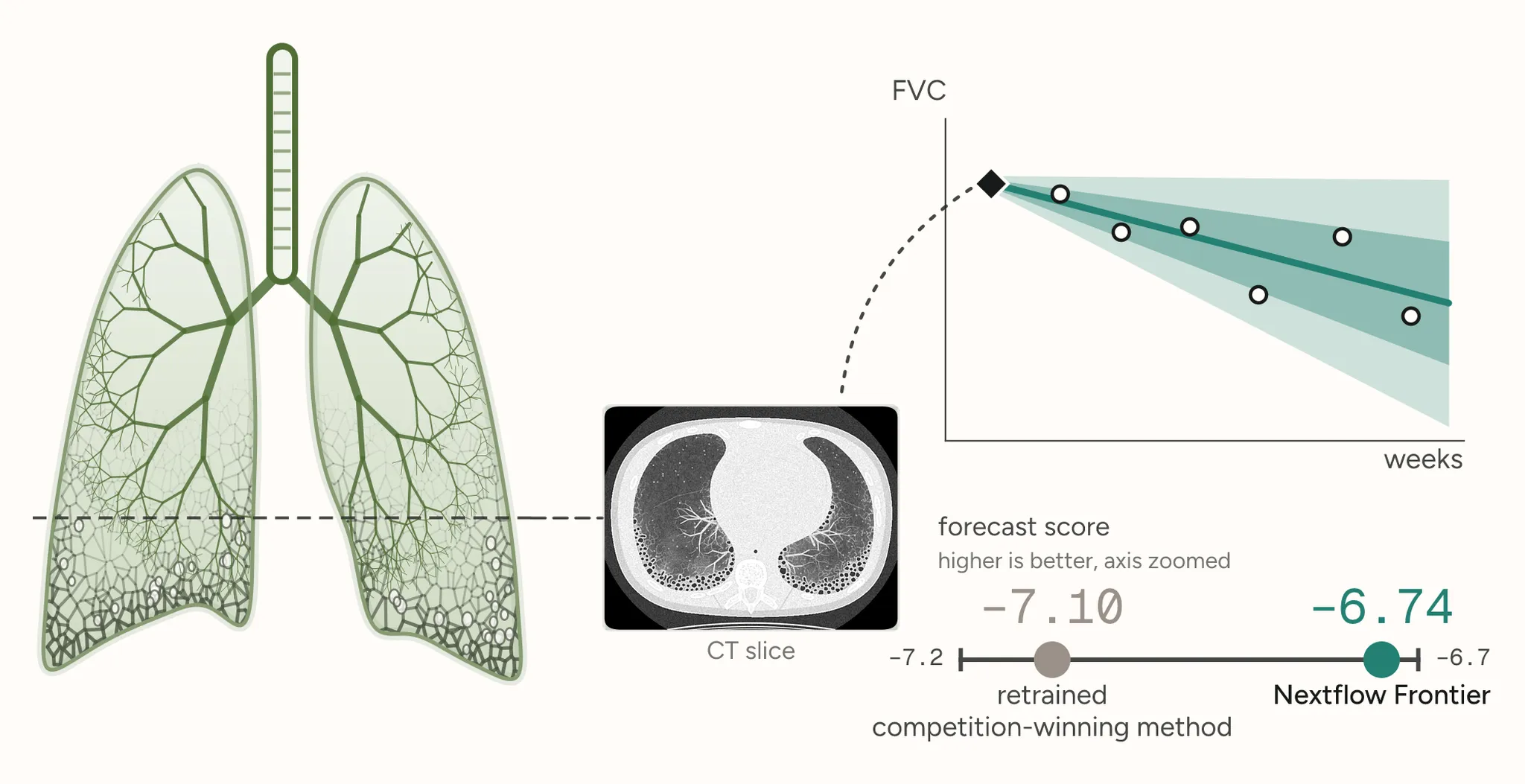 Illustrated lungs scarred at the base, a CT slice through them, and a forecast chart of FVC falling over weeks with widening bands, beside a score scale placing Nextflow Frontier at −6.74 and the retrained competition-winning method at −7.10