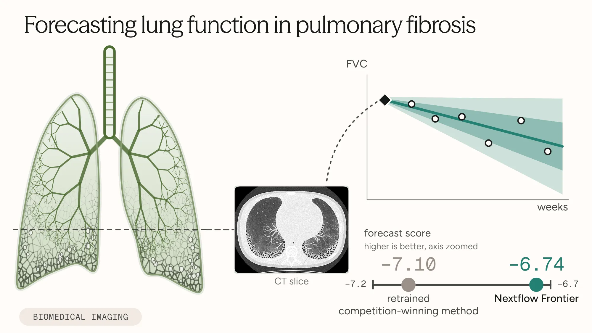 Figure: forecasting lung function in pulmonary fibrosis from CT scans.